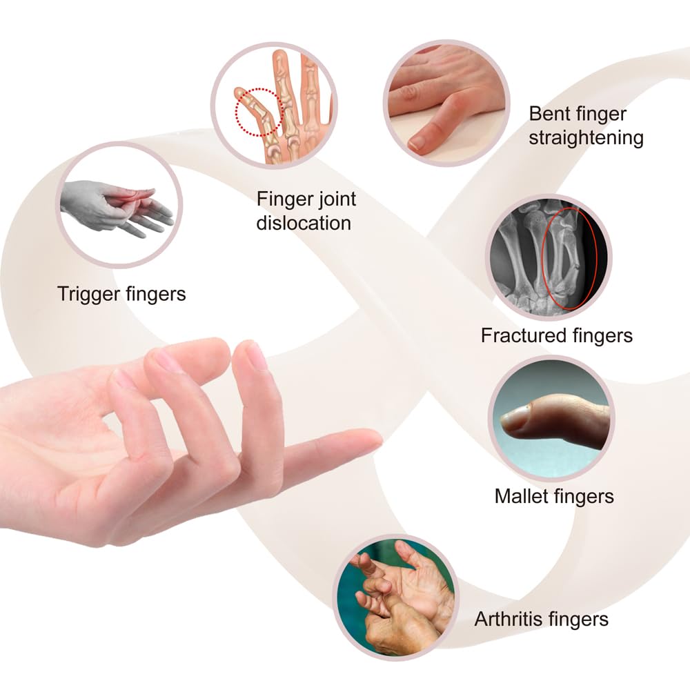 Oval Finger Splint 8 Pcs for Arthritis, Mallet Finger, Trigger Finger, Hypermobility