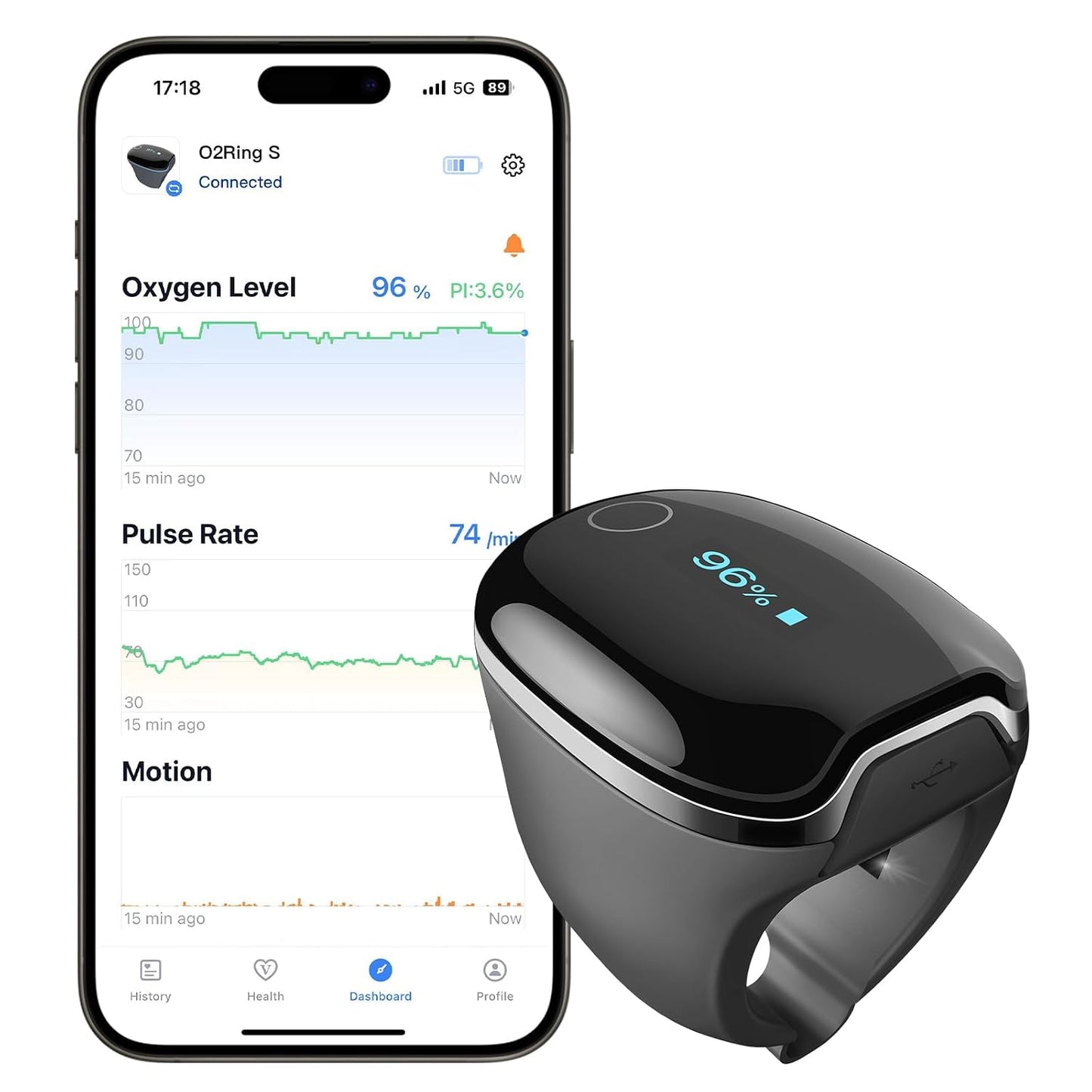 Wellue O2Ring-S Oxygen Monitor with Bluetooth Pulse Oximeter