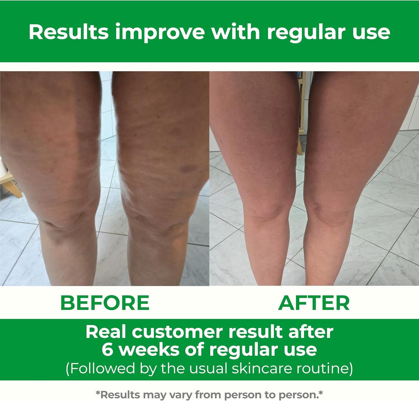 TESMED Manual Cellulite Massager Made in Italy with Converging Roller Technology