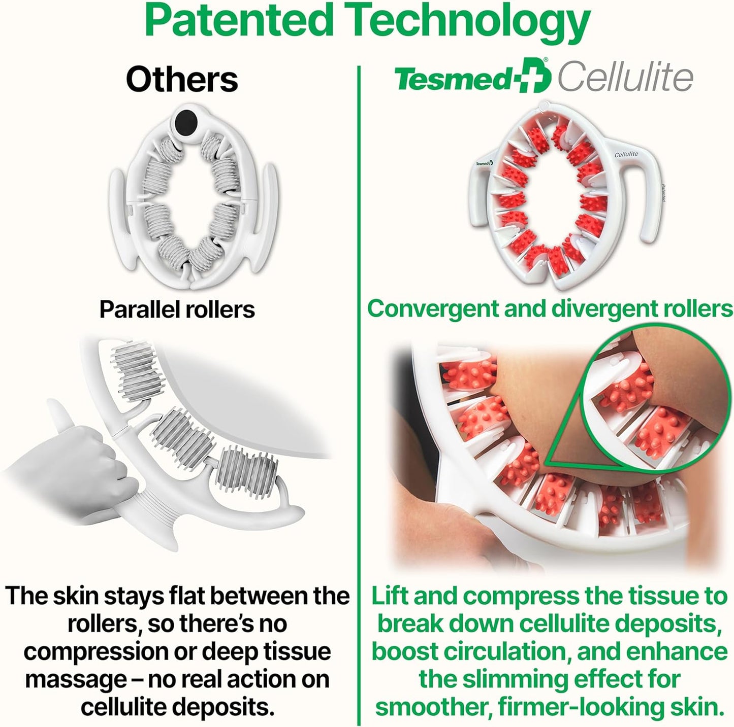 TESMED Manual Cellulite Massager Made in Italy with Converging Roller Technology