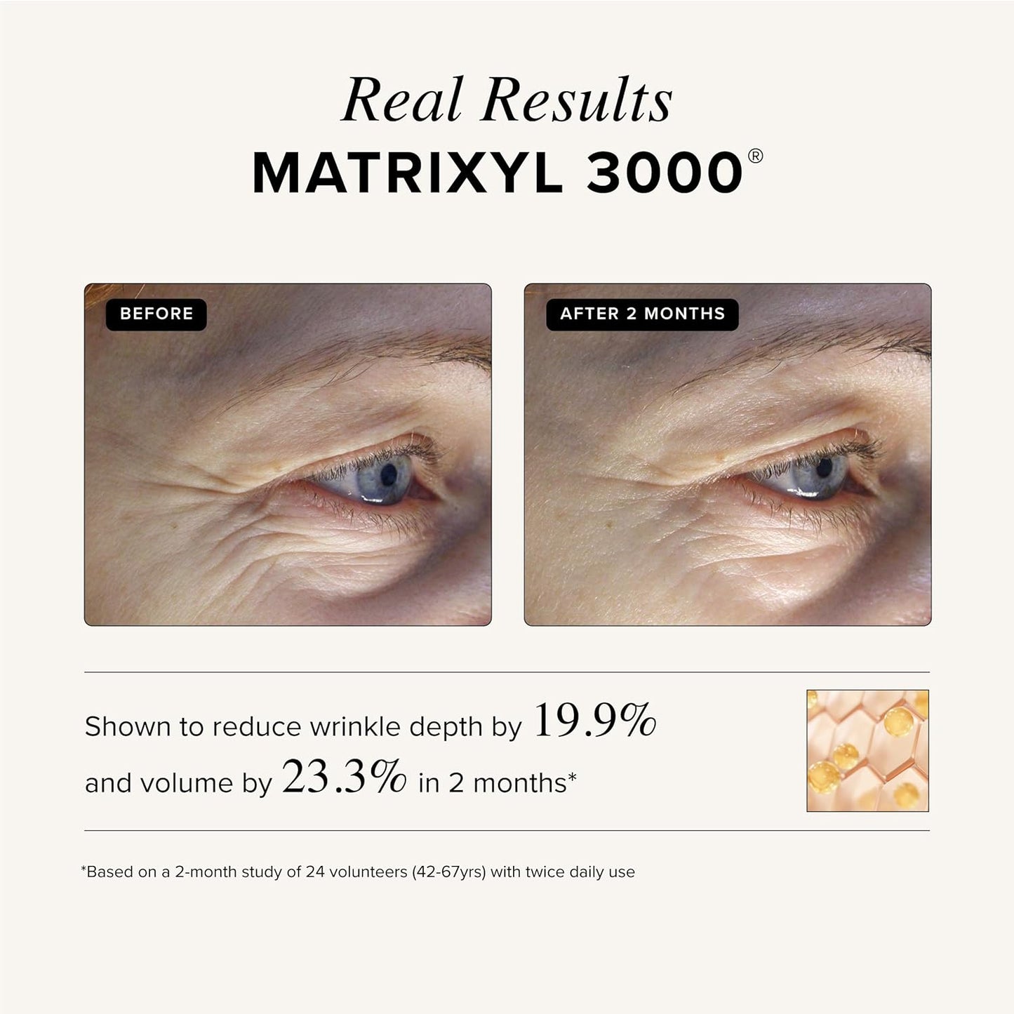 Asterwood Triple Repair Matrixyl 3000 + Argireline + Hyaluronic Acid + Vitamin C Serum for Face - Anti-Aging, Collagen Boosting, Hydrating - Fragrance-Free - 1 Fl Oz