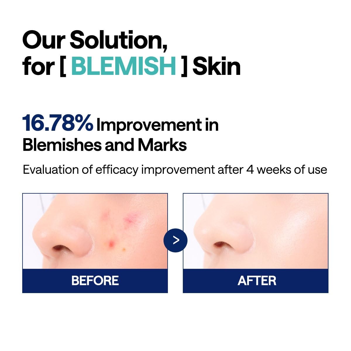 MEDIHEAL Madecassoside Toner Pads - with Centella Asiatica to Treat Blemishes and Improve Uneven Skin Tone - Vegan Gauze Fabric, 100 Pads