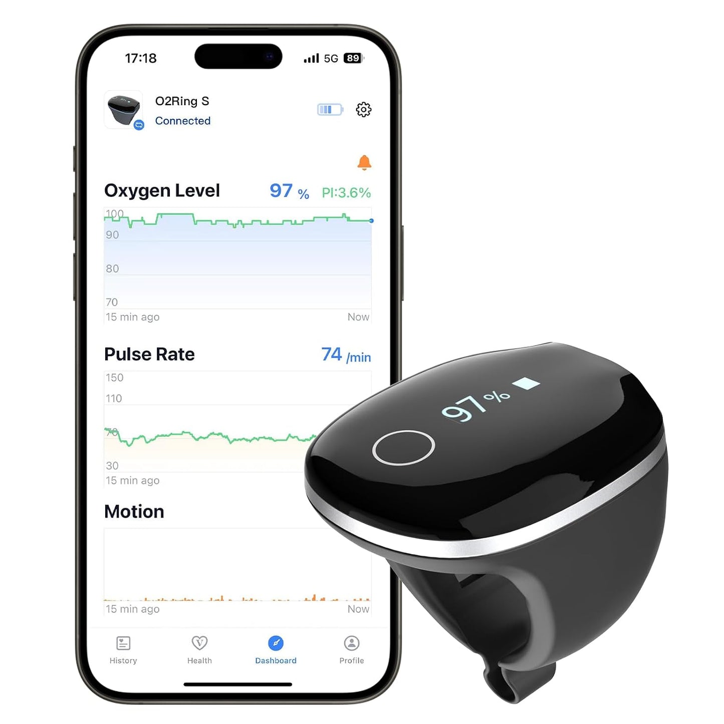 Wellue O2Ring-S Oxygen Monitor with Bluetooth Pulse Oximeter