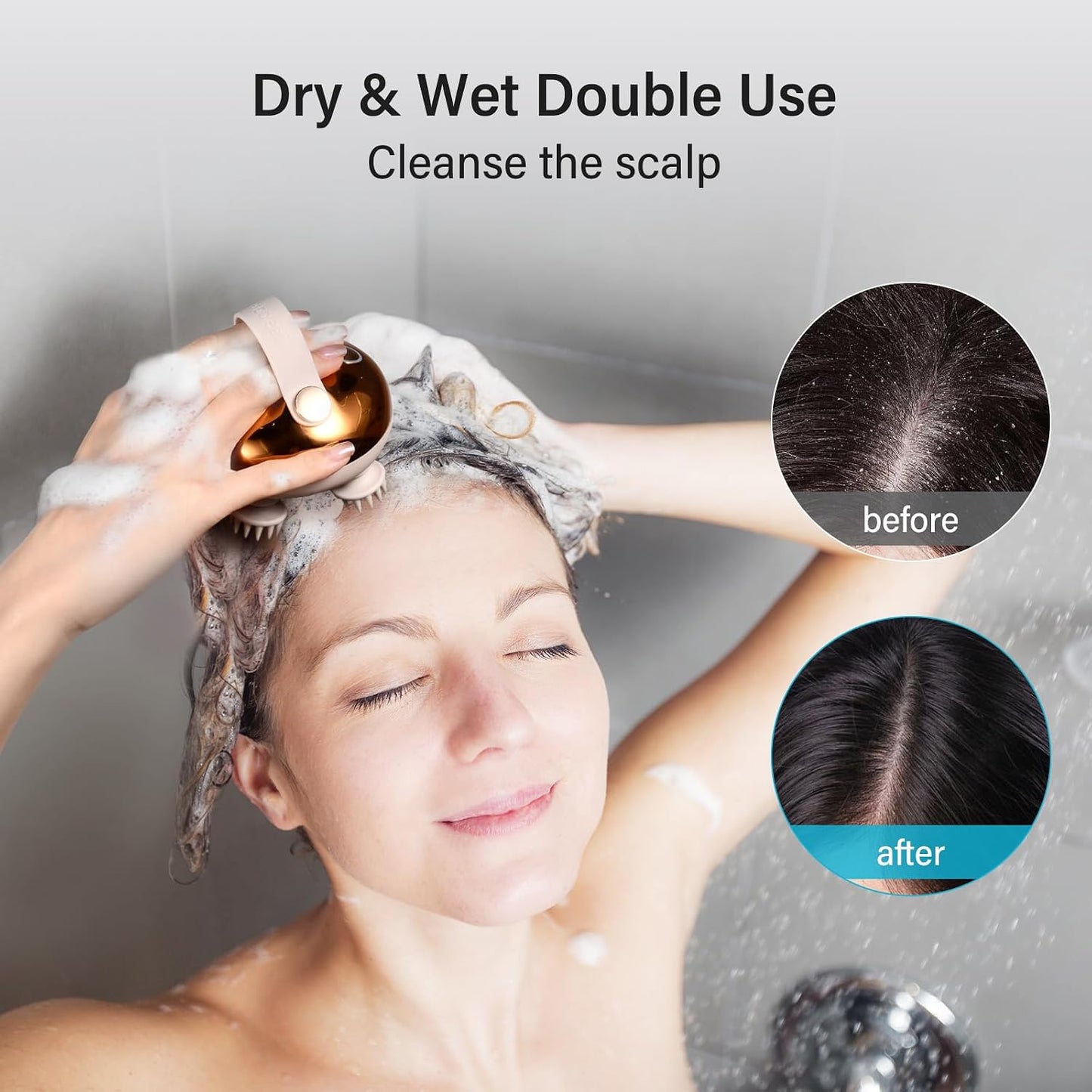 arboleaf Electric Scalp Massager with 5 in 1 Kneading and 128 Massage Nodes