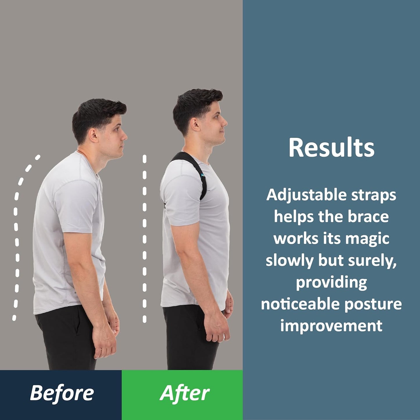ComfyBrace Posture Corrector Back Brace for Men and Women Adjustable