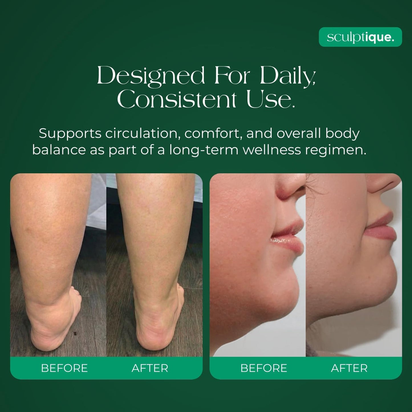 Lymphatic Drainage Supplement with Dandelion, Burdock, Cleavers & Echinacea