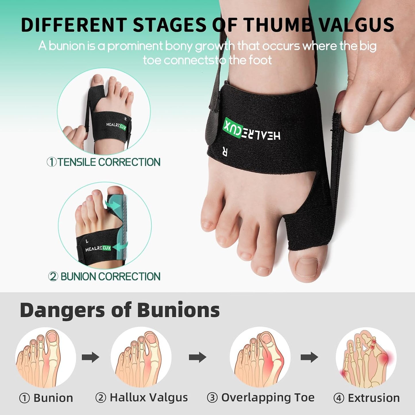 Healrecux Bunion Corrector for Women and Men, 1 Pair, Big Toe Straightener