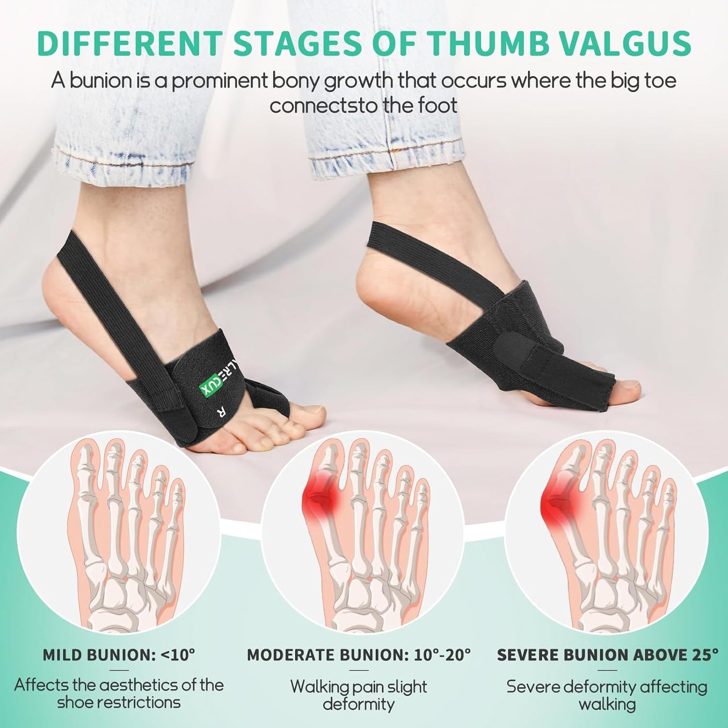 Healrecux Bunion Corrector for Women and Men, 1 Pair, Big Toe Straightener